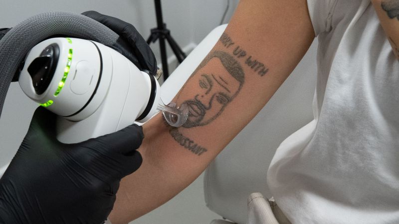 Este estudio de eliminación de tatuajes de Londres seguirá eliminando los tatuajes de Kanye West de forma gratuita